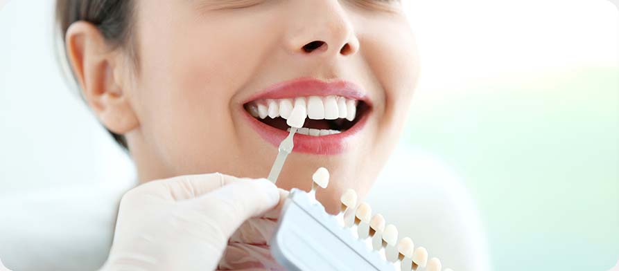 SW Calgary Porcelain Veneers | West Peaks Dental Suite | General & Family Dentist | SW Calgary