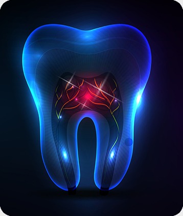 SW Calgary Root Canal Therapy | West Peaks Dental Suite | General & Family Dentist | SW Calgary