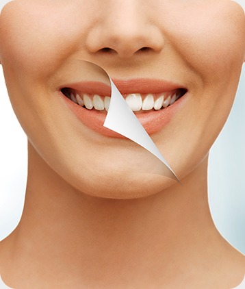 SW Calgary Teeth Whitening | West Peaks Dental Suite | General & Family Dentist | SW Calgary